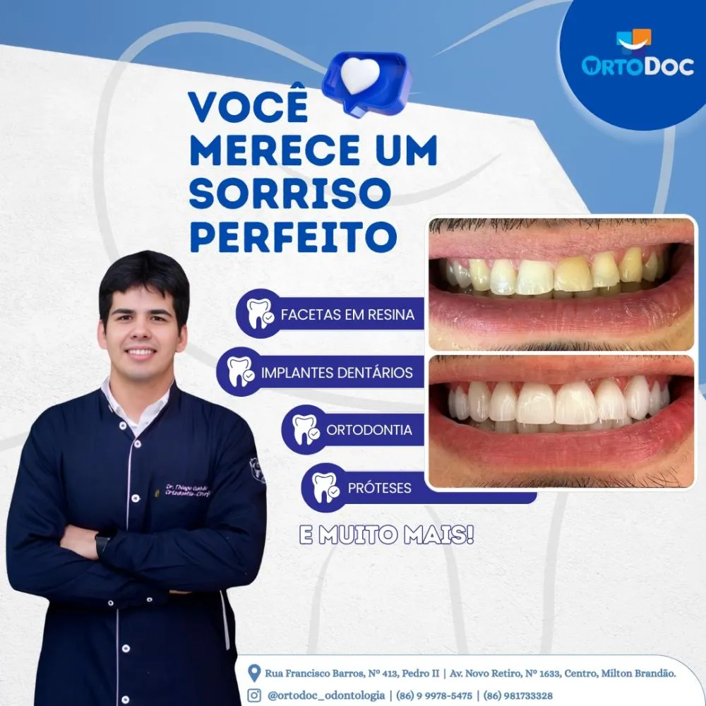 Realce a beleza do seu sorriso com os tratamentos odontológicos da Ortodoc!