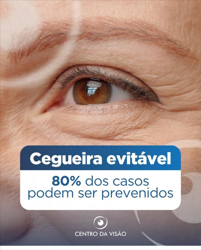 Cuide da saúde dos seus olhos com o Centro da Visão em Pedro II!