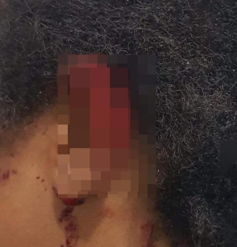 Marido é preso após arrancar parte da orelha da esposa com mordida, em Castelo do Piauí