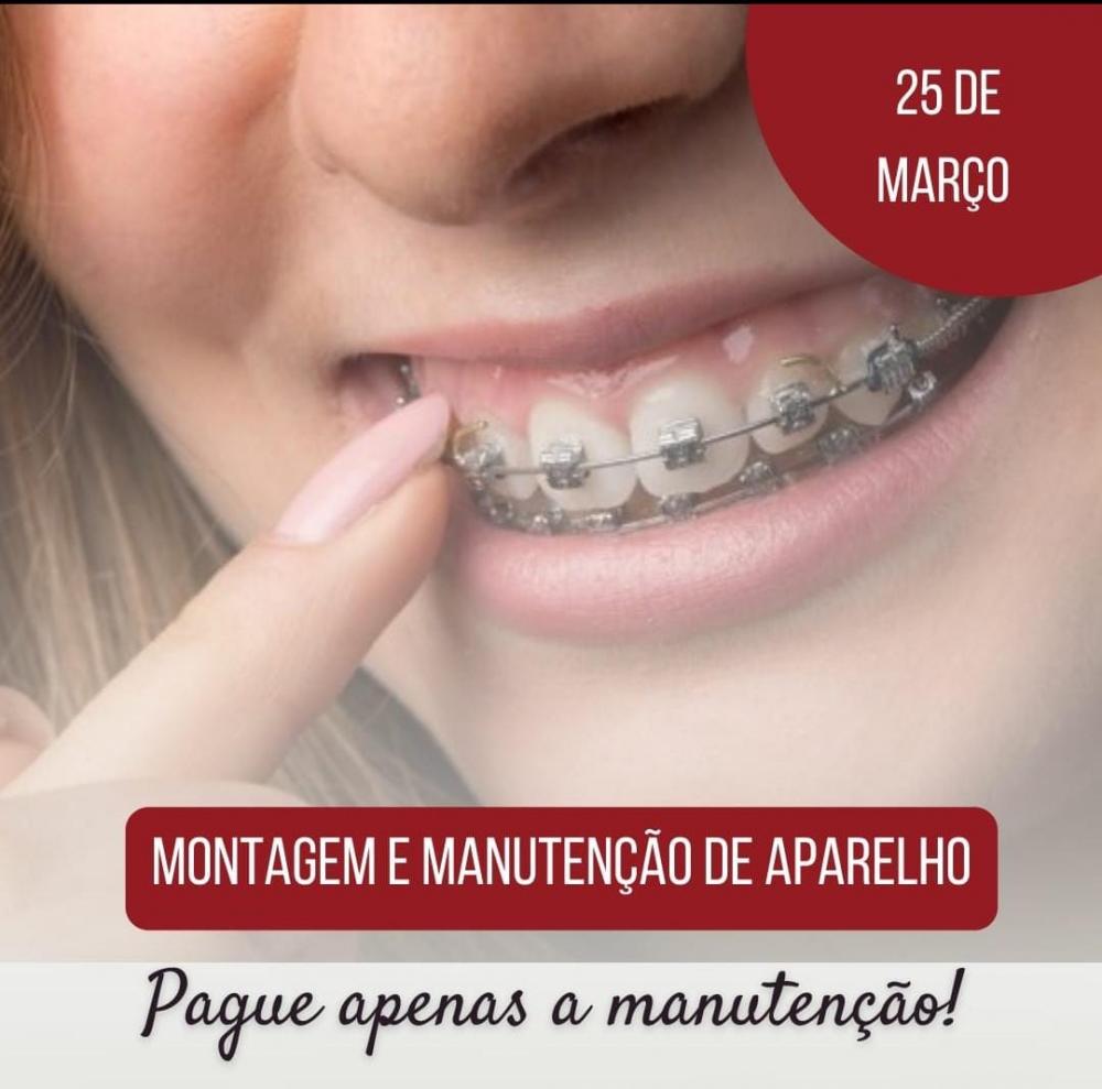 Nesta sexta-feira, 25 de março, teremos montagem e manutenção de aparelho ortodôntico na Clínica Vittalis; agende já a sua consulta! 