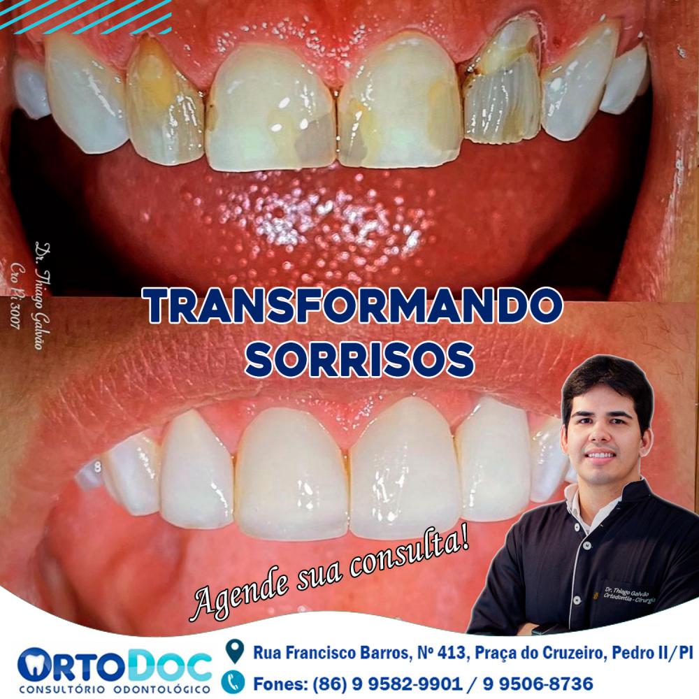 ORTODOC é referência em serviços odontológicos, agende já a sua consulta e transforme o seu sorriso!