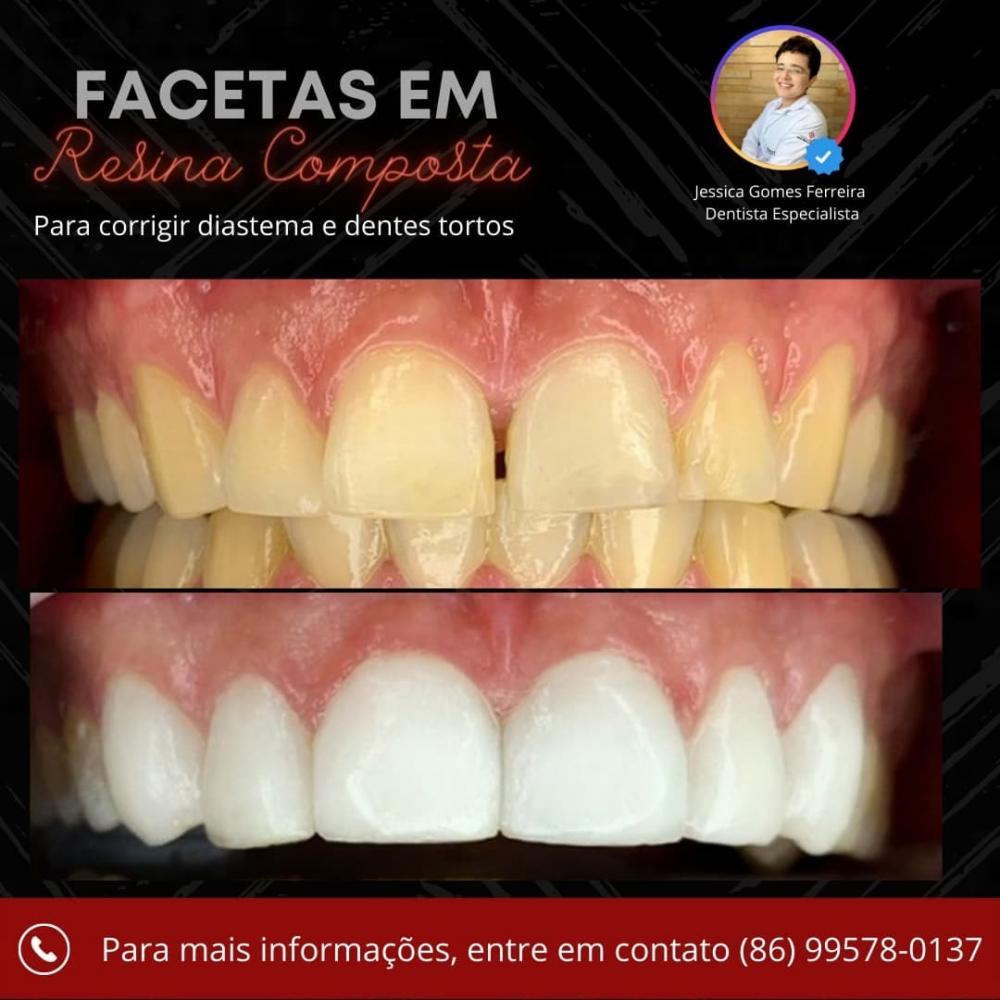 Venha mudar o seu sorriso com a Clínica Vittalis de Pedro II; agende já a sua consulta!