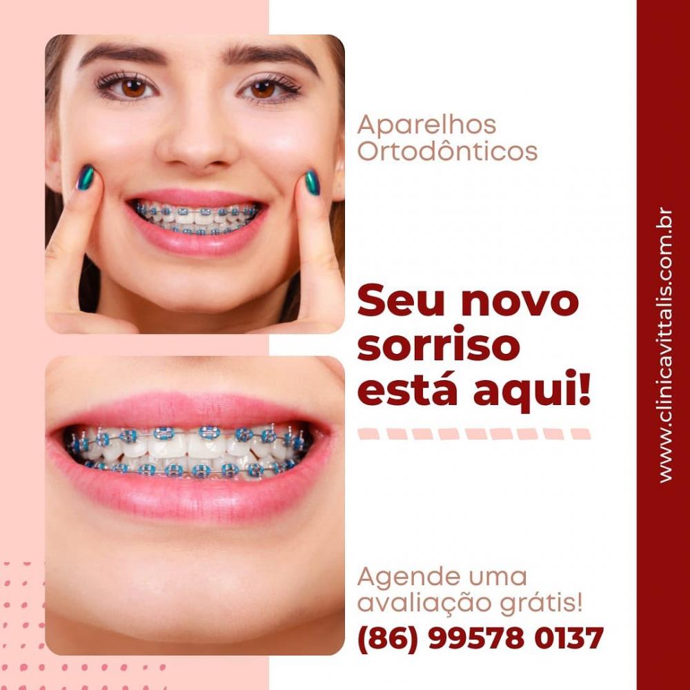 Agende já a sua avaliação e traga o seu sorriso de volta na Clínica Vittalis de Pedro II