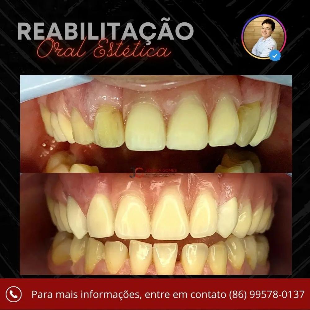 Agende já a sua avaliação e traga o seu sorriso de volta na Clínica Vittalis de Pedro II