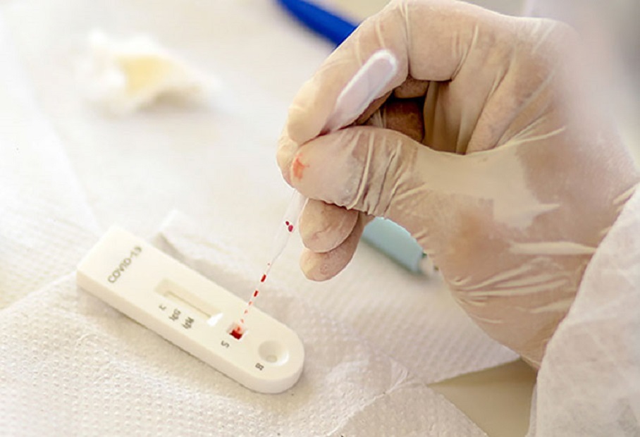 Índice de testes positivos para Covid volta a crescer no Piauí, aponta Fiocruz