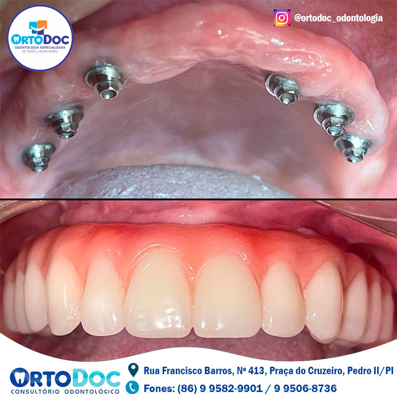 ORTODOC é referência em serviços odontológicos especializados, agende já a sua consulta e transforme o seu sorriso!