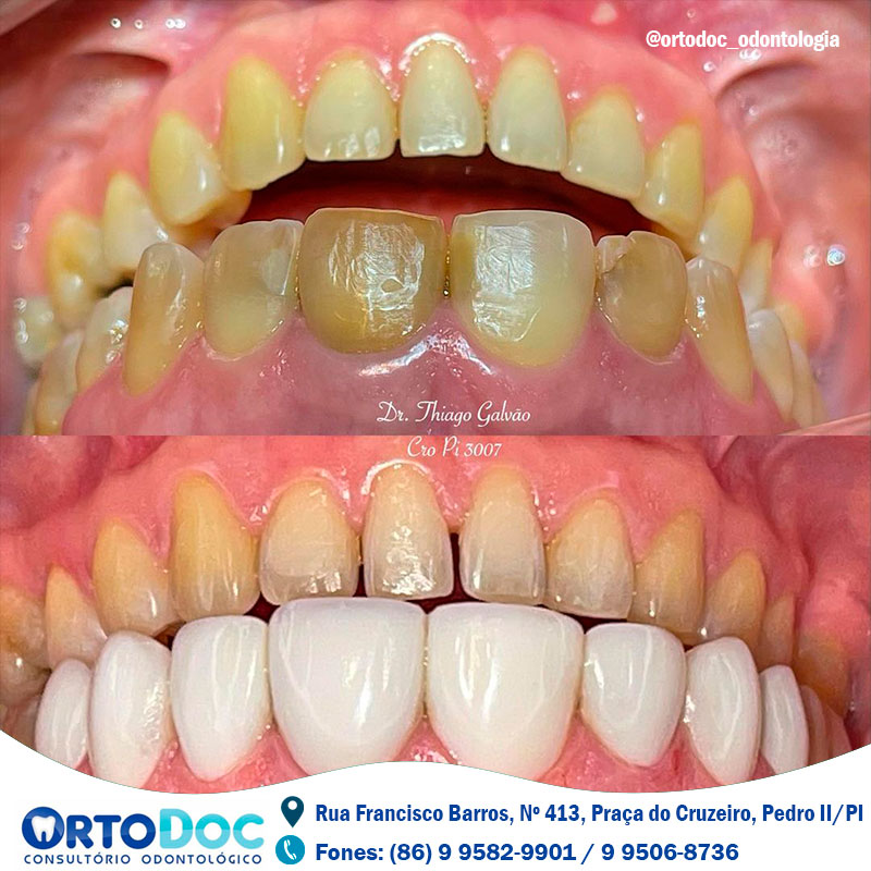 ORTODOC é referência em serviços odontológicos especializados, agende já a sua consulta e transforme o seu sorriso!