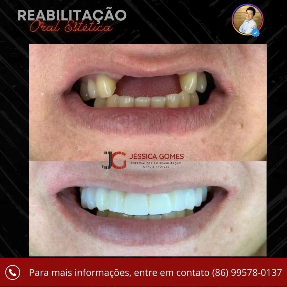 Venha mudar o seu sorriso com a Clínica Vittalis de Pedro II; agende já a sua consulta!