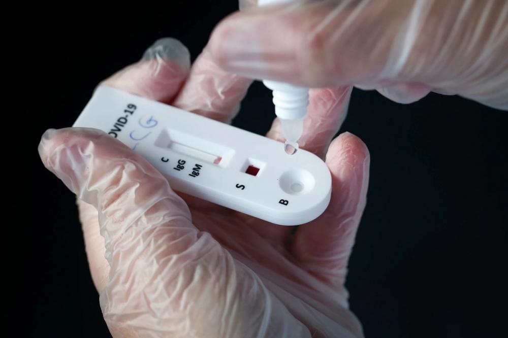 Piauí registra 698 casos de Covid e 4 óbitos pela doença nas últimas 24 horas