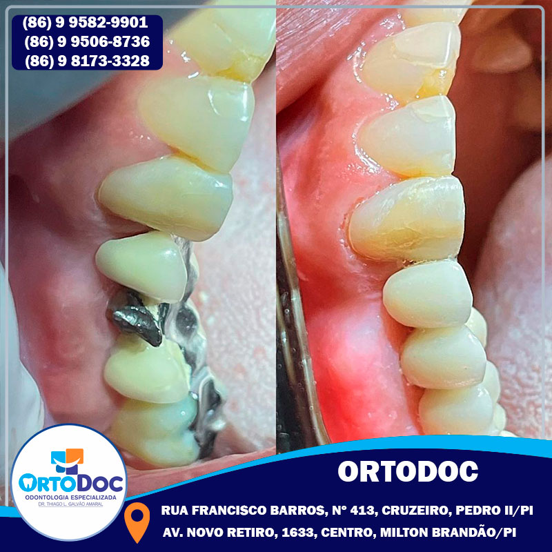 ORTODOC é referência em serviços odontológicos especializados, agende já a sua consulta e transforme o seu sorriso!