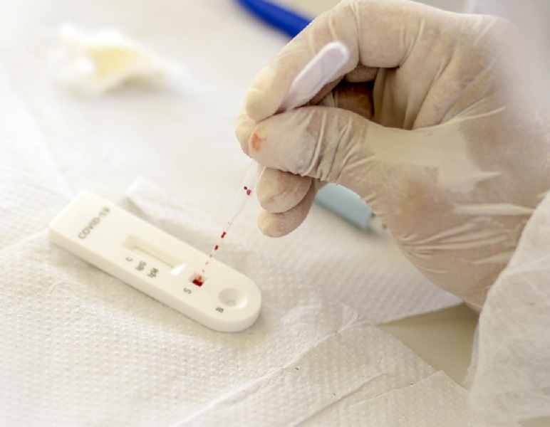 Piauí registra mais 392 casos e 3 mortes por Covid-19, diz Sesapi