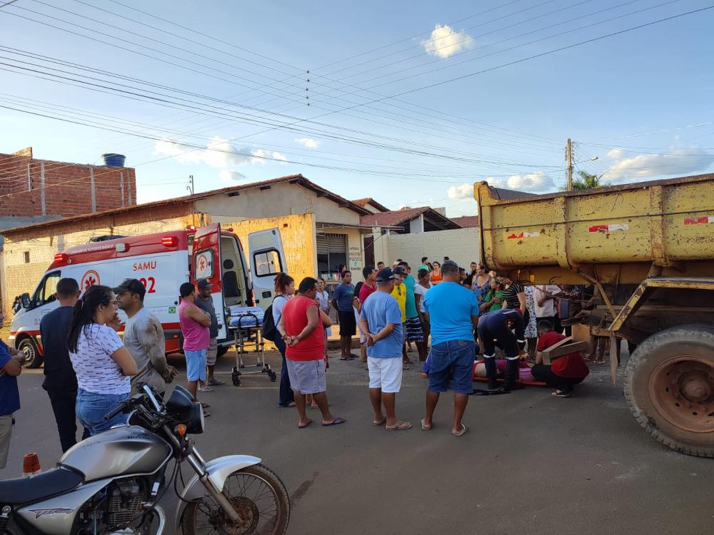 Mulher sofre fratura exposta em grave acidente envolvendo moto e caçamba em Pedro II