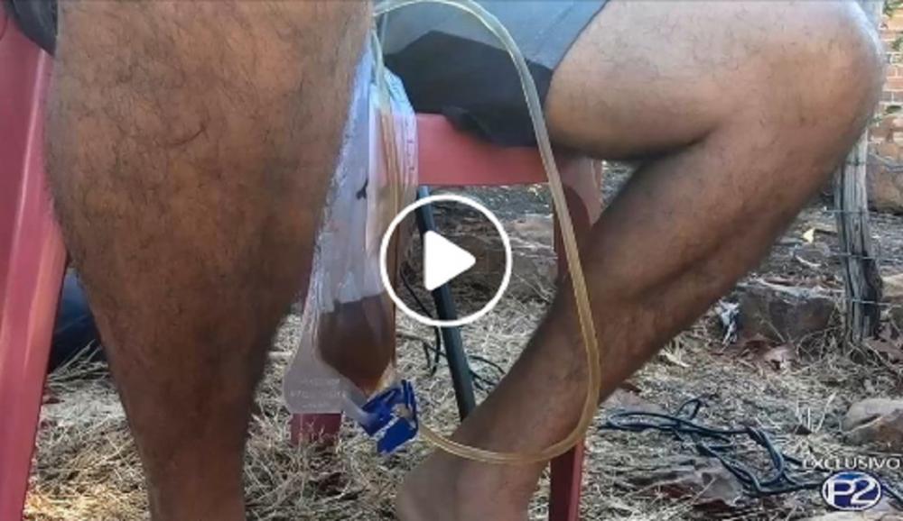 Exclusivo: Homem que teve o pênis quase decepado conversou com a equipe do Portal P2, e acredita ter sido dopado antes de dormir; confira!