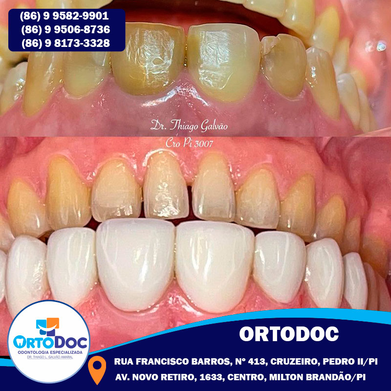 Seu sorriso merece o melhor, merece ser cuidado na Ortodoc Odontologia; agende sua consulta!