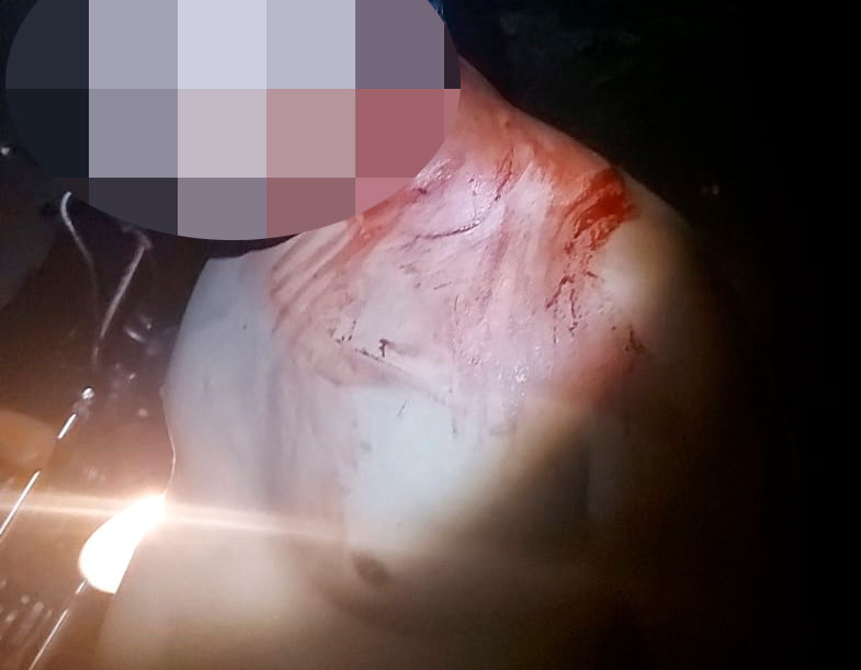 Homem é esfaqueado por mulher no Parque das Opalas em Pedro II 