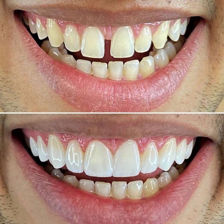 Agende já a sua Avaliação na OdontoCompany de Pedro II; conheça os nossos serviços!