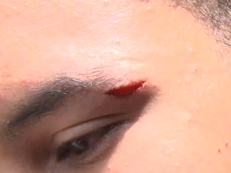 Homem é acusado de tentar estuprar e agredir adolescente de 17 anos em Pedro II 