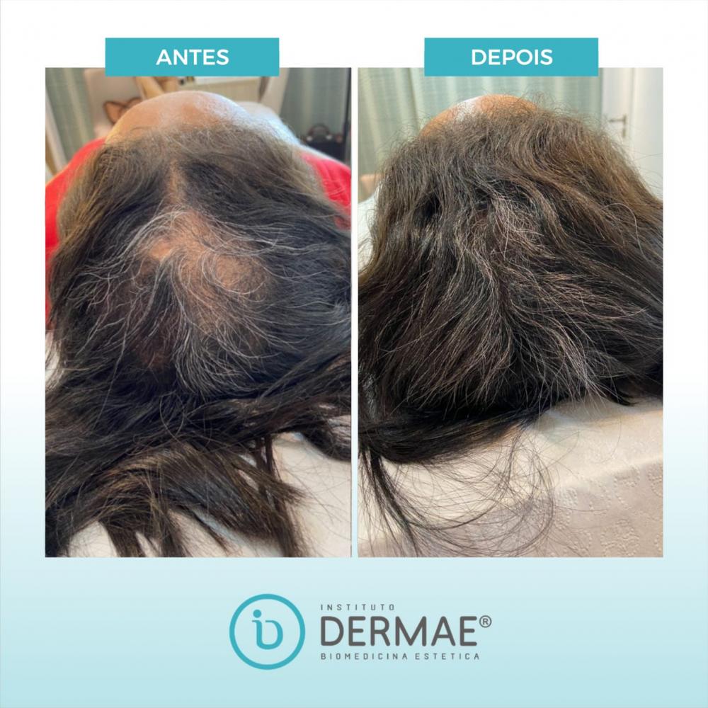 Instituto Dermae: Tratamentos Estéticos Avançados em Pedro II