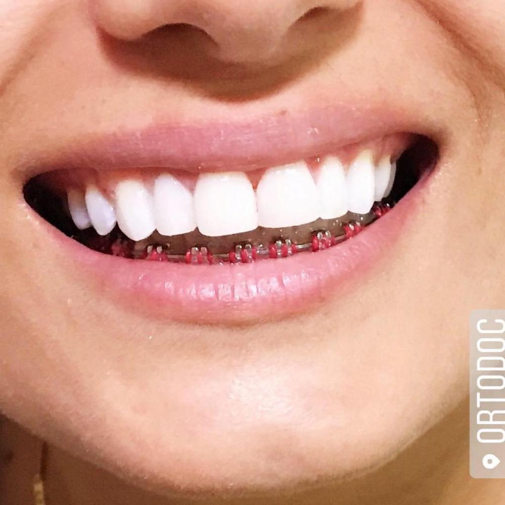 Ortodoc: A clínica odontológica com excelência em tratamentos ortodônticos