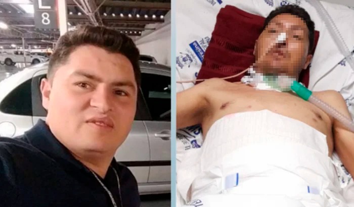 Família realiza campanha solidária para custear tratamento de homem vítima de grave acidente em Pedro II