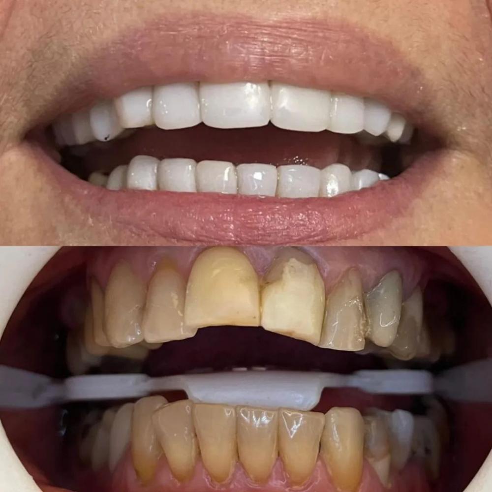 Venha para a Ortoestética de Pedro II e transforme sua vida com um sorriso saudável e bonito!