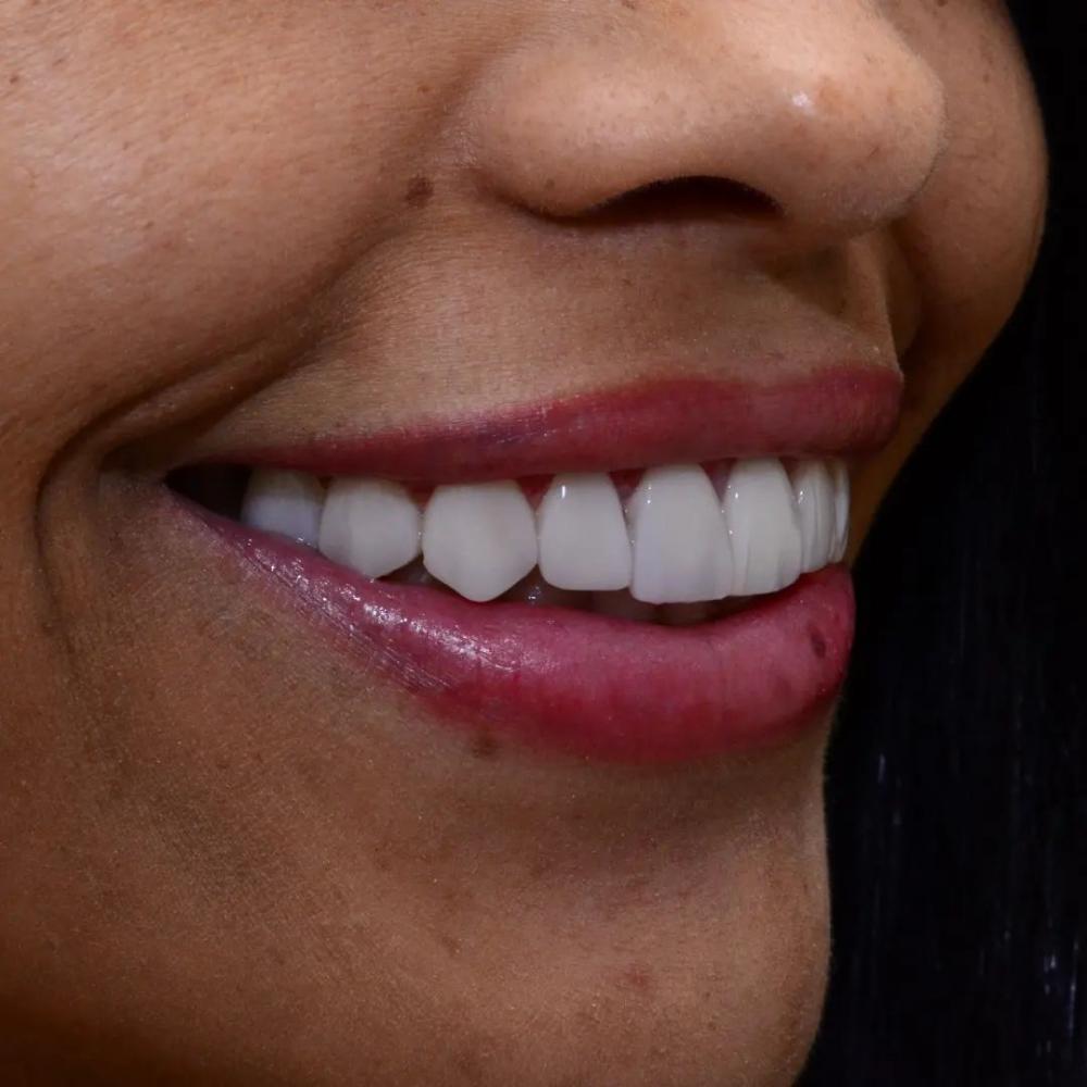 Transforme o seu sorriso na Clínica Ortoestética, com a estrutura mais moderna da região!