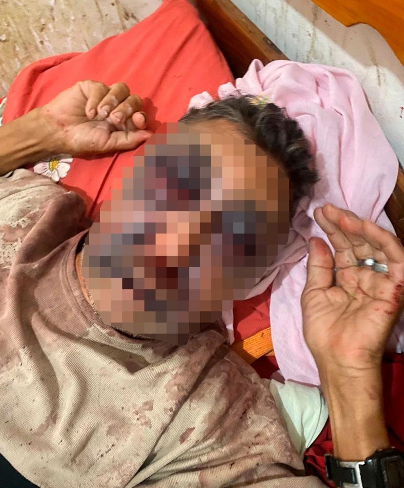 Agressão brutal deixa vítima gravemente ferida em Milton Brandão