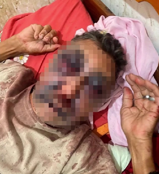 Homem é brutalmente agredido na cidade de Milton Brandão; Comandante local da PM, Sgt. Allan Johnson, fala sobre o caso! 