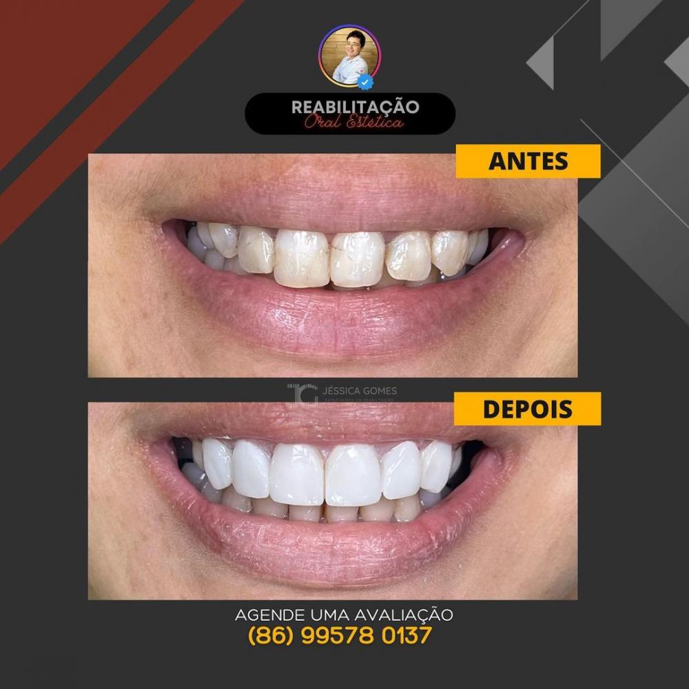 Transforme seu sorriso com as opções de tratamentos odontológicos da Clínica Vittalis!