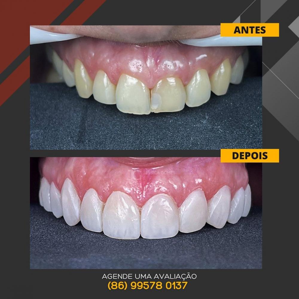 Transforme seu sorriso com os tratamentos odontológicos da Clínica Vittalis!