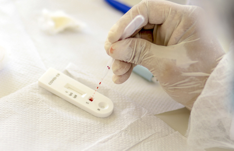 Sesapi registra 190 novos casos e dois óbitos por covid no Piauí