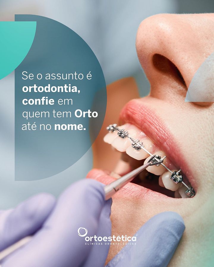 Tenha o sorriso que você sempre sonhou com os tratamentos odontológicos da Clínica Ortoestética!