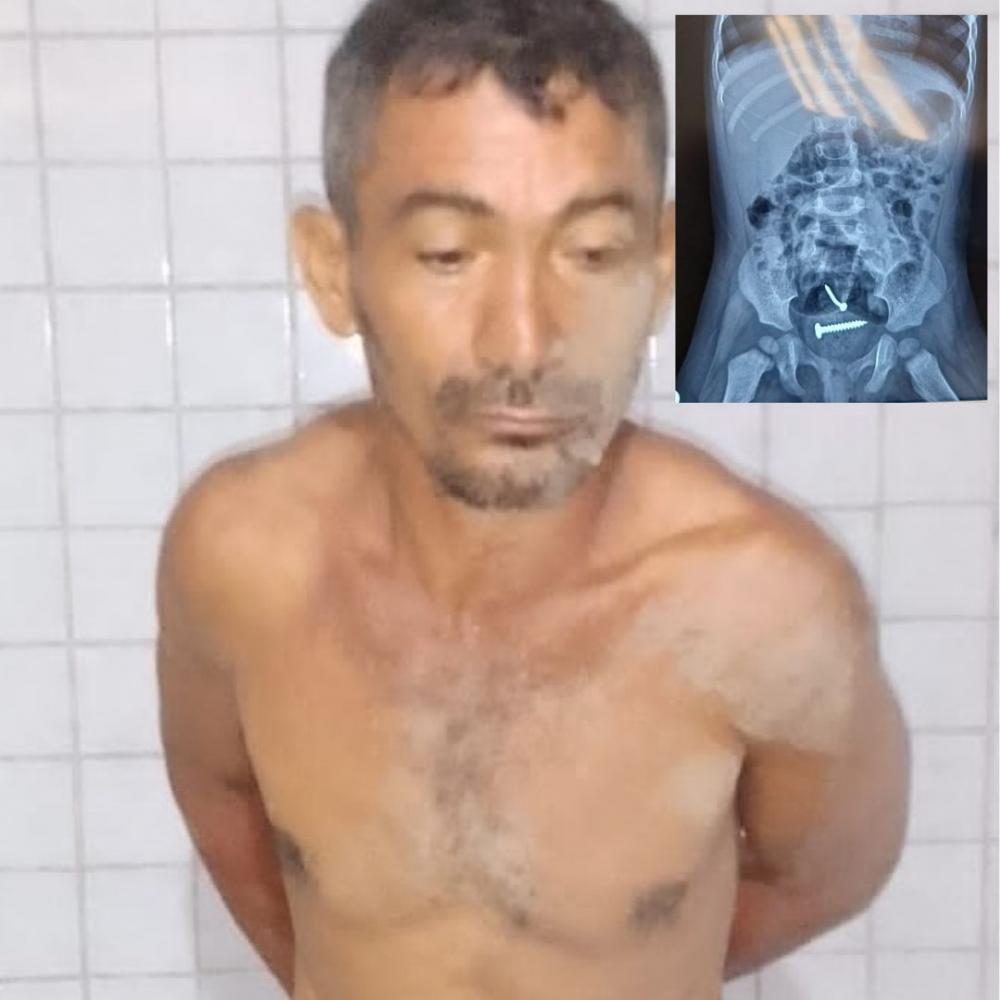 Homem é acusado de violentar esposa e filha de 1 ano na zona rural de Pedro II; o acusado está foragido na região de Milton Brandão