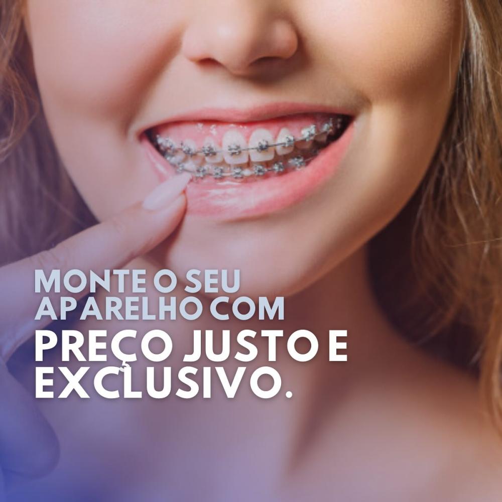 Inicie 2024 com o sorriso renovado, monte seu aparelho ortodôntico na Clínica Vittalis!