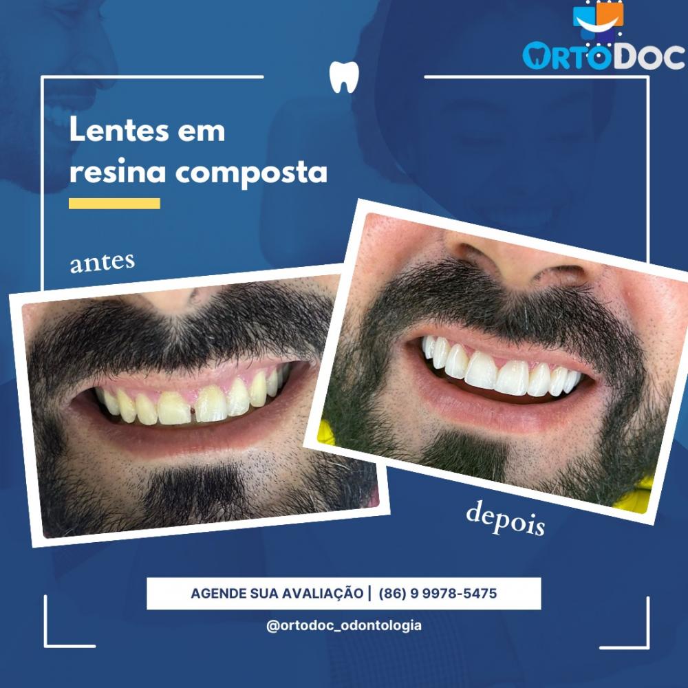 Comece o ano com o sorriso renovado, agende já sua consulta na Ortodoc!