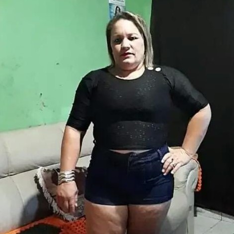 Pedrossegundense enfrenta problemas de saúde e família lança campanha para o tratamento