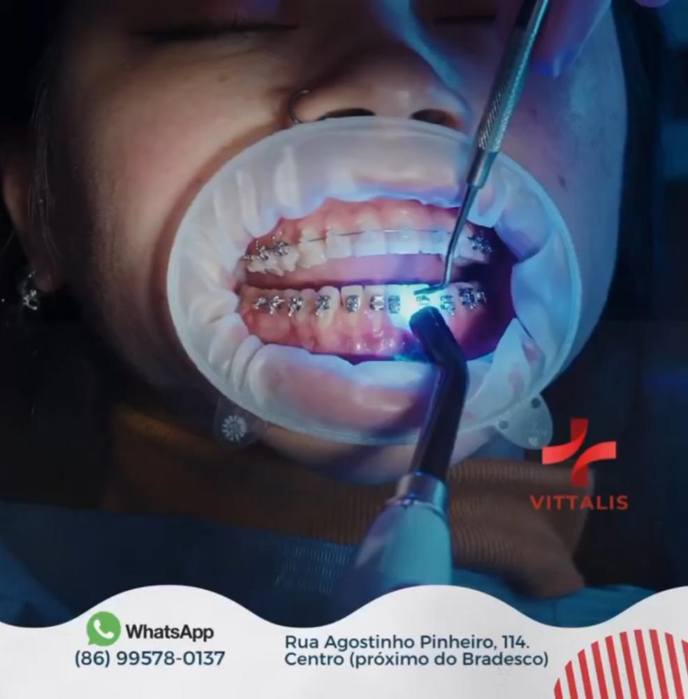 Conquiste o sorriso dos seus sonhos em 2024 com a Clínica Vittalis de Pedro II!