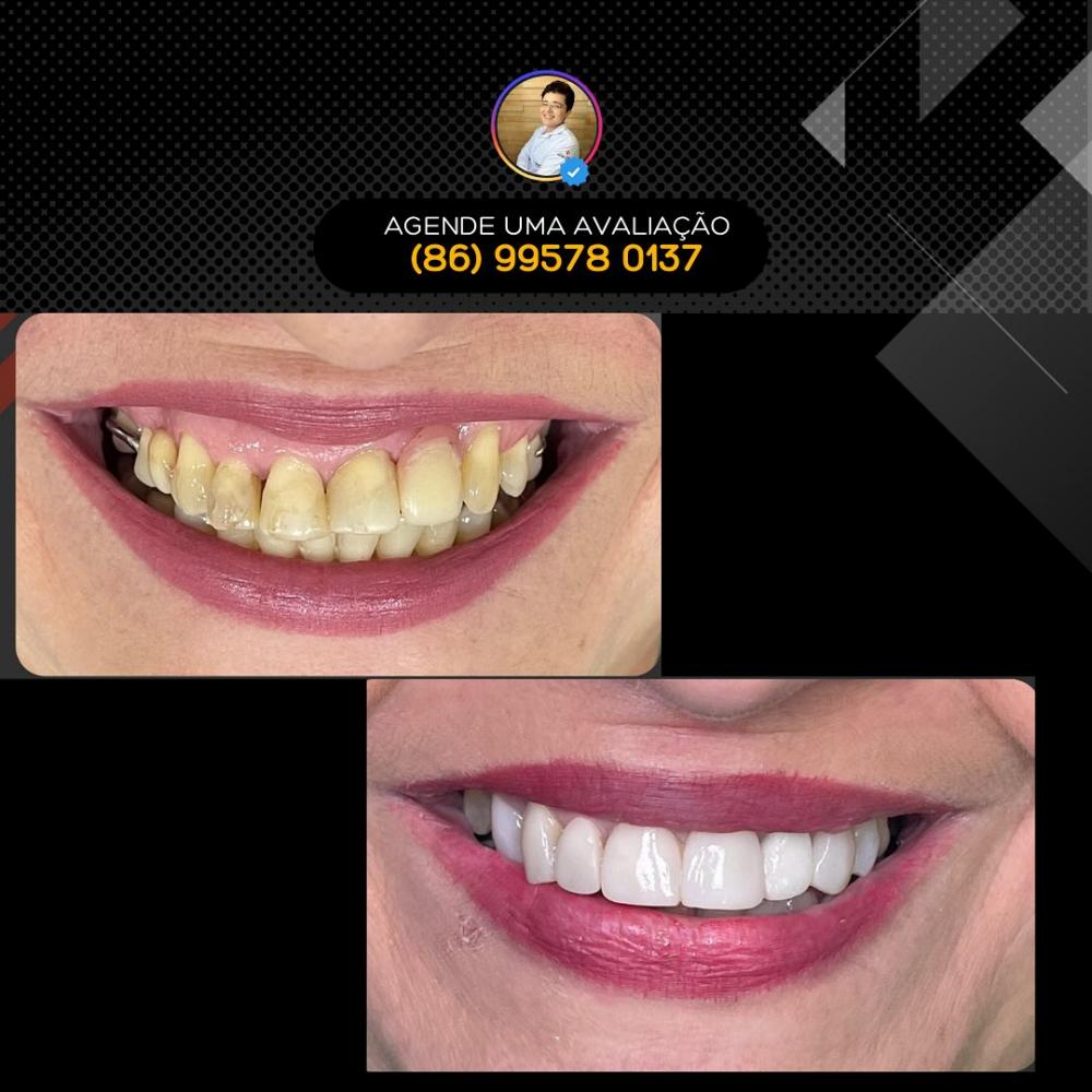 Tenha o sorriso dos seus sonhos com os tratamentos odontológicos da Clínica Vittalis!