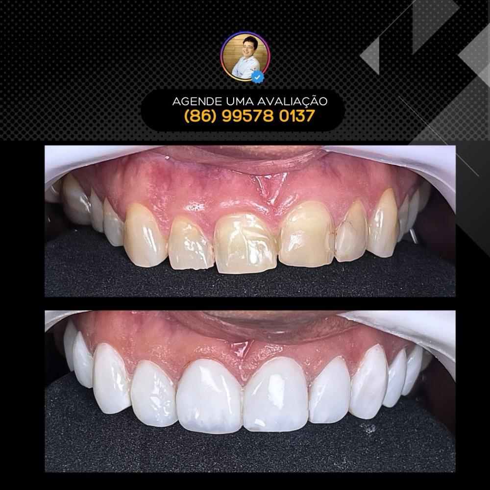 Transforme seu sorriso com os tratamentos odontológicos da Clínica Vittalis!