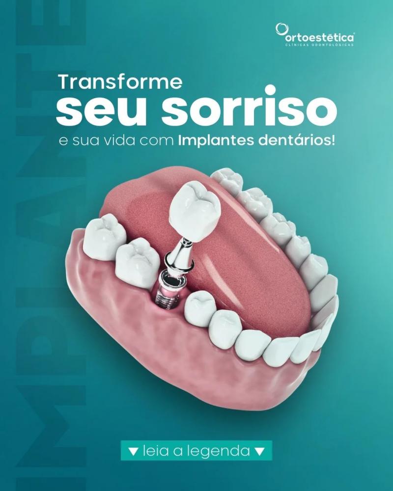 Transforme seu sorriso e sua vida com os implantes dentários da Clínica Ortoestética de Pedro II!