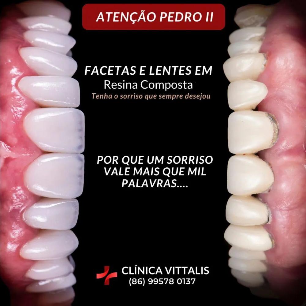 Conquiste um sorriso brilhante e saudável com os tratamentos odontológicos da Clínica Vittalis!