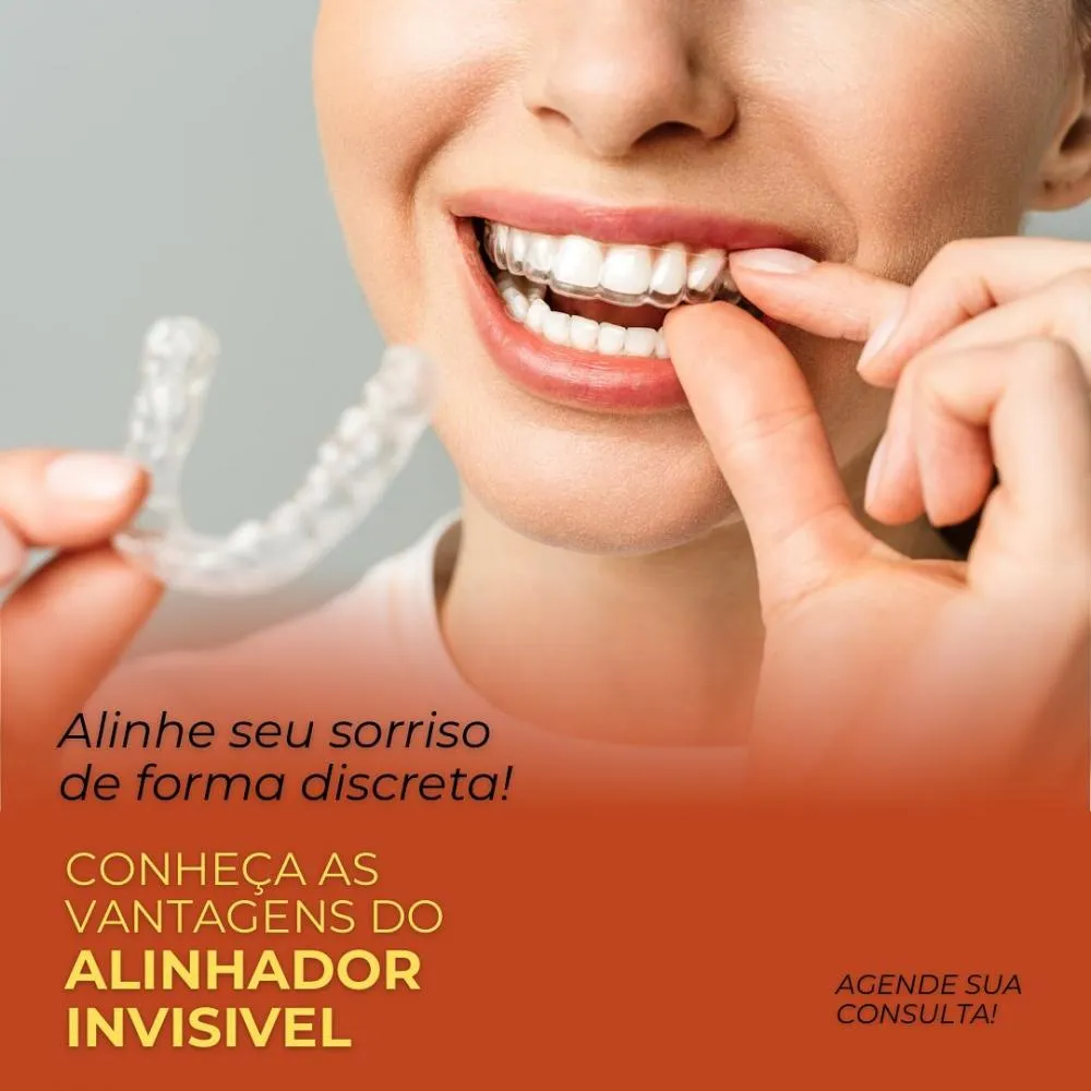 Alinhe seu sorriso de forma discreta, conheça as vantagens do alinhador invisível da Clínica Vittalis!