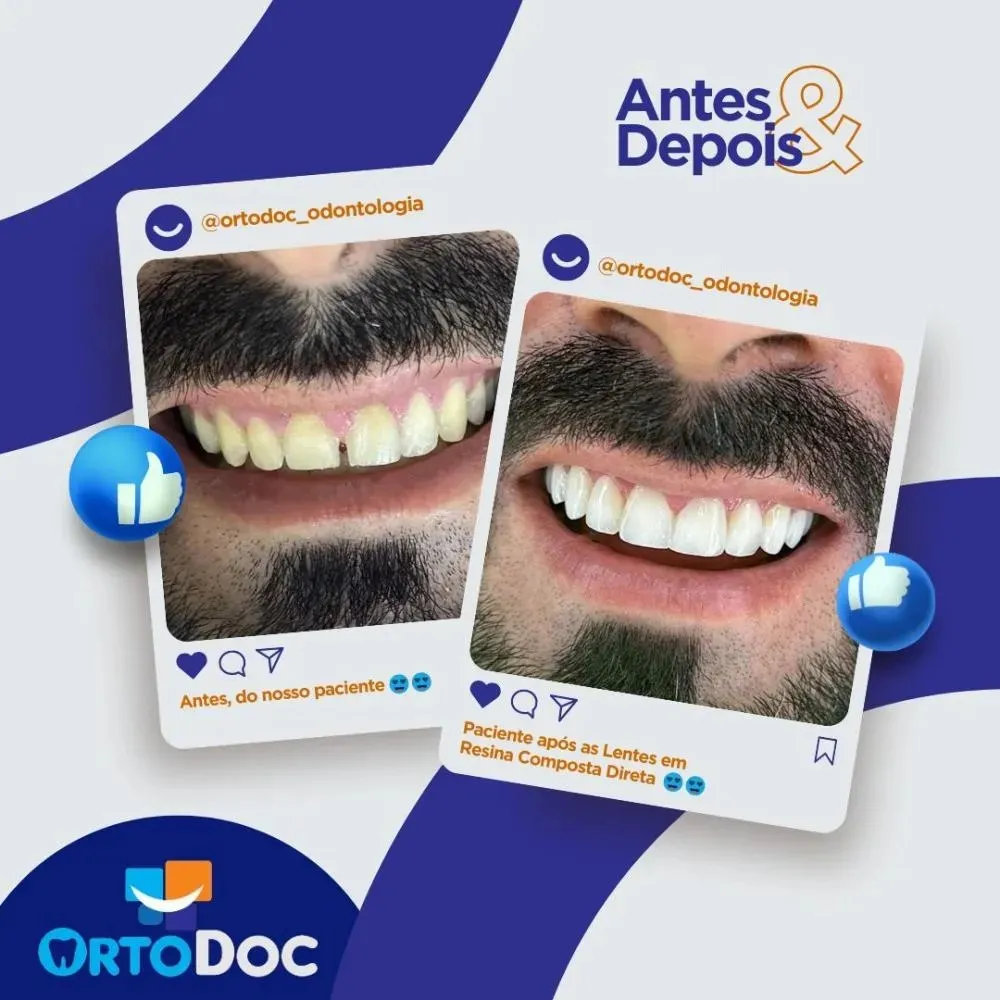 Venha para a Ortodoc, a escolha certa para tratamentos odontológicos de qualidade em Pedro II!