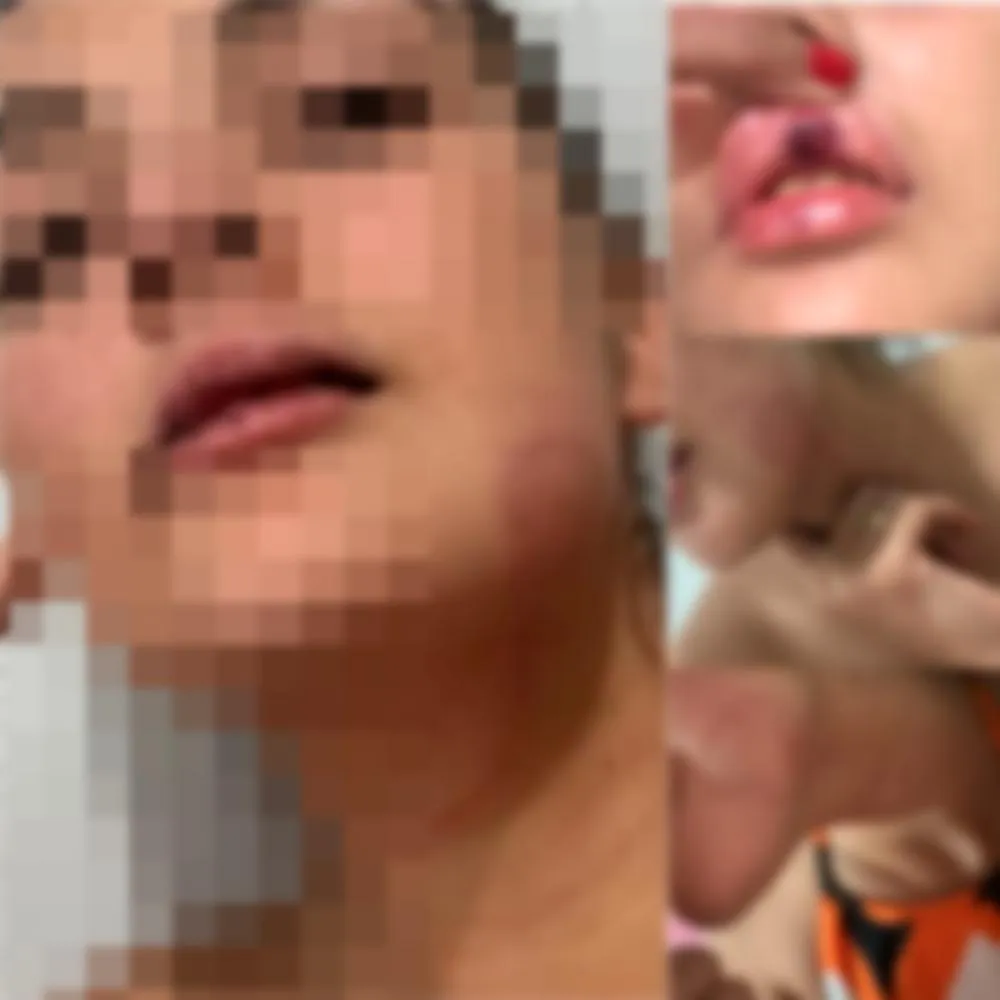 Engenheira de 25 anos é vítima de agressão e violência pelo ex-namorado em via pública de Pedro II