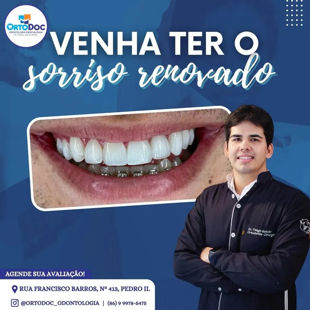 Conquiste um sorriso perfeito com a Ortodoc, agende sua avaliação!