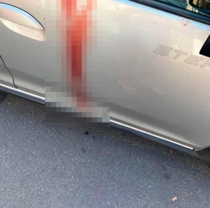 Jovem de Pedro II é atacada a facadas pelo companheiro e está em estado grave em São Paulo 