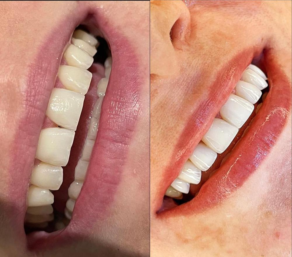 Ano novo, sorriso novo! Aproveite para investir na beleza dos seus dentes na Ortodoc de Pedro II