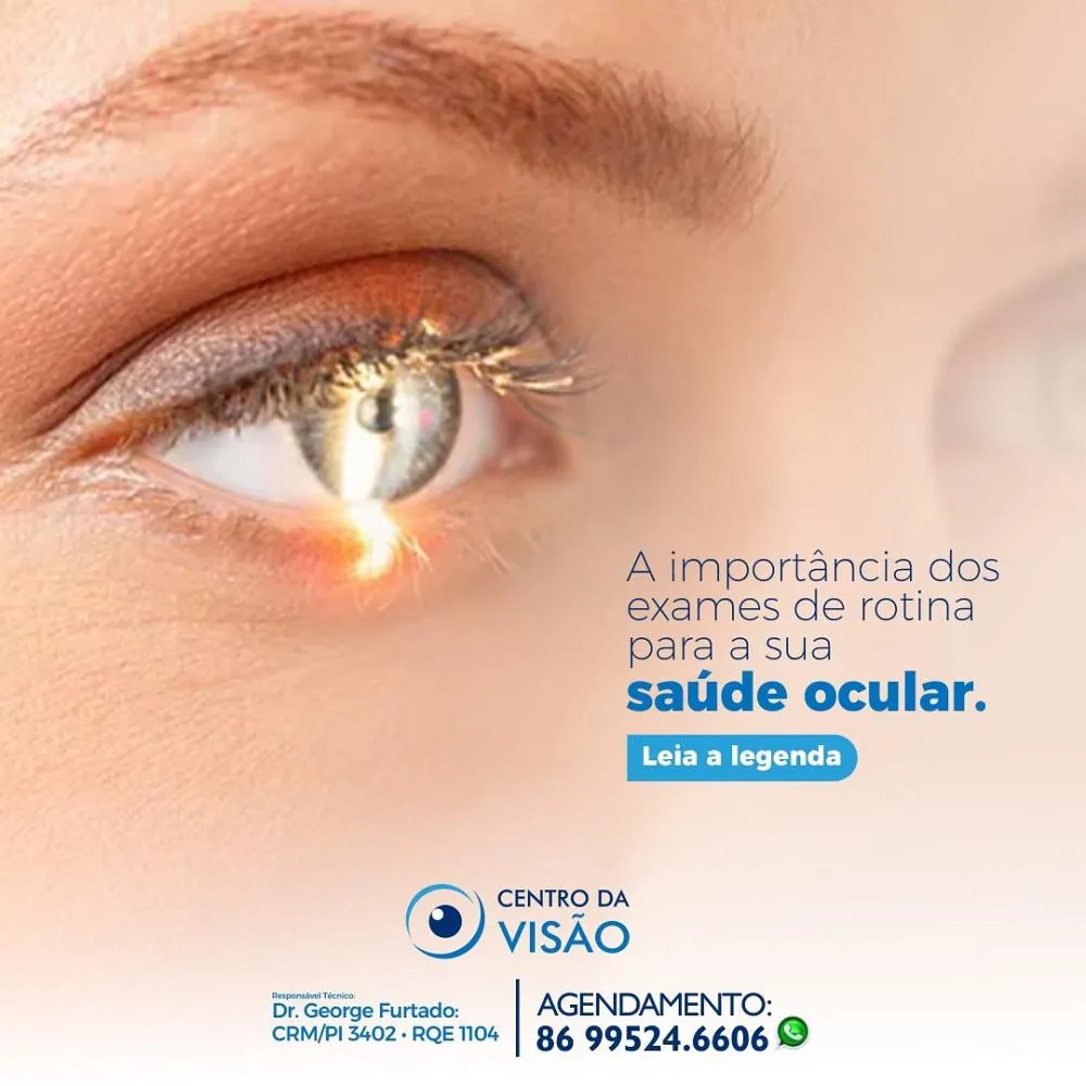 Cuide da sua visão com os melhores especialistas, agende sua consulta no Centro da Visão de Pedro II!