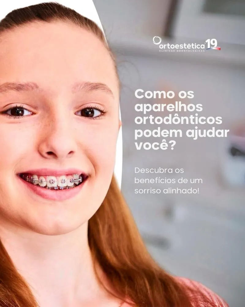 Transforme seu sorriso com os aparelhos ortodônticos da Clínica Ortoestética!