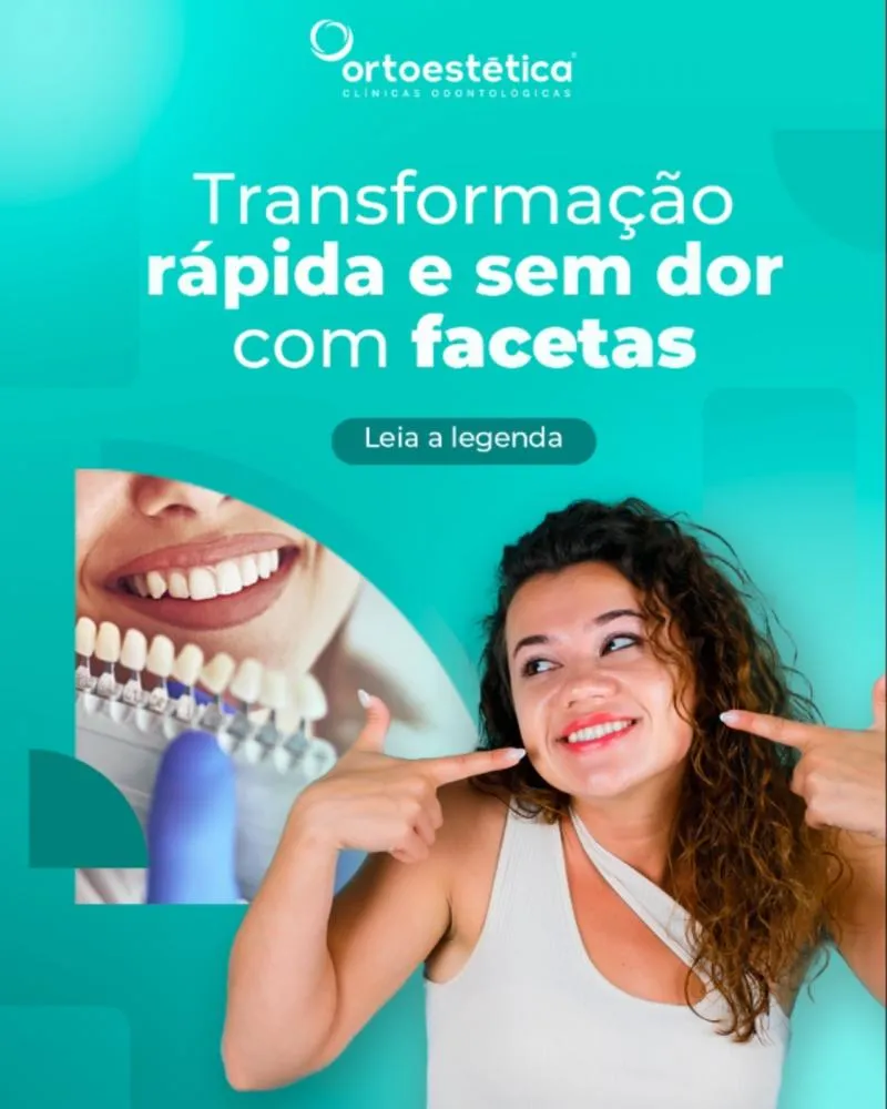Tenha um sorriso radiante com as facetas em resina composta da Ortoestética de Pedro II!
